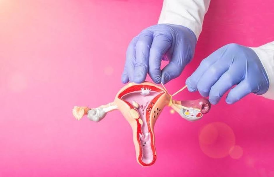 Suami Gak Mau Steril? Kenali Dulu Metodenya Suami Kenali Dulu Metode Steril